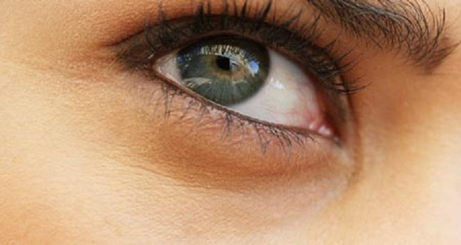 Kızaran göze dikkat