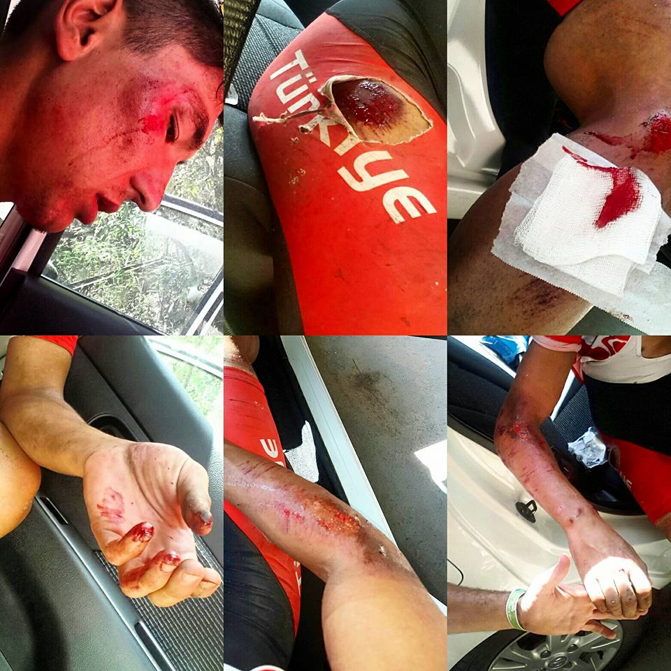 Ahmet Örken, Rio'da kaza geçirdi