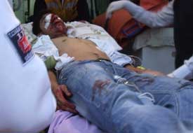 Tuzlukçu'da kavgaya kan bulaştı: 2 ölü