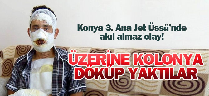 Terhisine 2 Ay Kalan Askeri 4 Arkadaşı Öldüresiye Dövüp Yaktı!