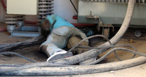 Bombalanan hastanede kopan bacağı için protez bekliyor