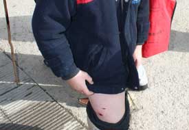 Köpekler çocuğu hastanelik etti