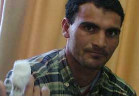 Eline düşen taş parmağını kopardı