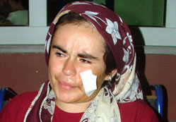 Silahlı kavgada 2 kişi yaralandı