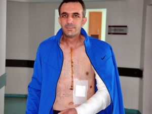 "Kazayla" hayatta kaldı