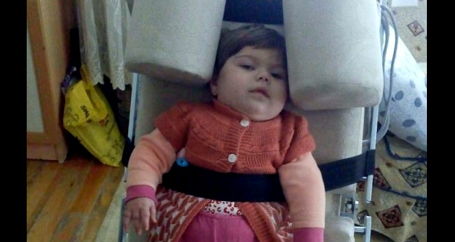 Görme, konuşma ve yürüme yetisini kaybeden Berre bebek yardım bekliyor