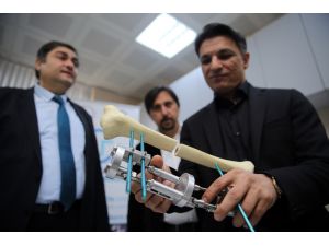 Kırıklarda "alçı"ya son verecekler