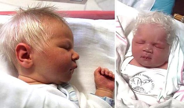 Bebek bembeyaz saçlarla doğdu, gerçek şoke etti!