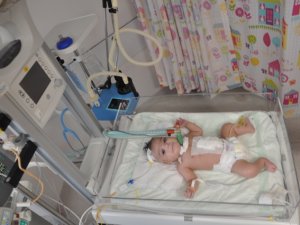 Minik Yılmaz "30 dakikalık" mola sonrası yaşama tutundu