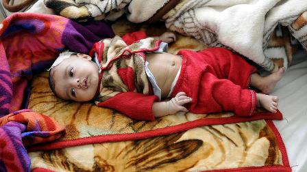 UNICEF: Yemen'de 10 milyon çocuk acil yardıma muhtaç