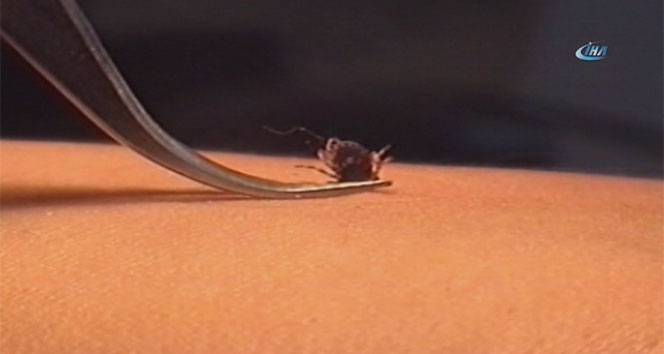 Çorum’da keneden ölüm: 4 çocuk babası yaşlı adam öldü