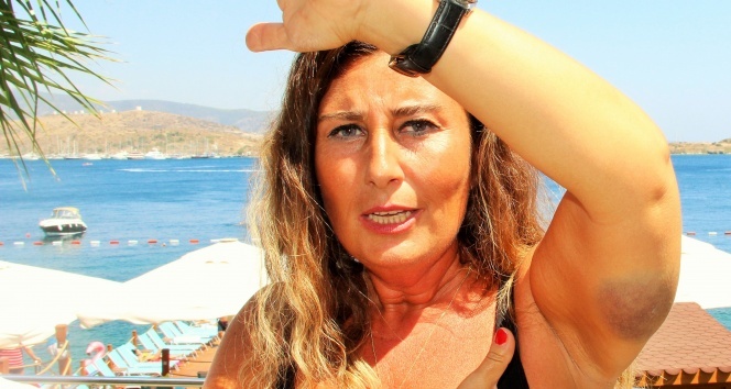 Bodrum'da caretta caretta saldırısı: 2 yaralı