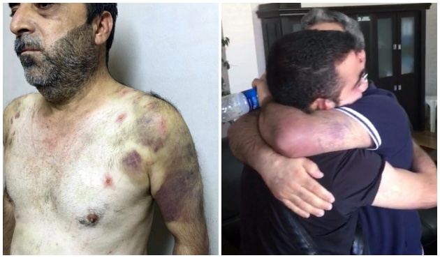 Kaçırıp, kırbaç ve hortumla işkence yaptılar! / VİDEO