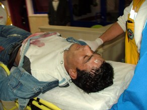 Yanlışlıkla bıçaklamış