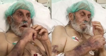 Yoğum bakım hastasına sigara verip dalga geçtiler