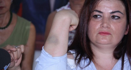 Mersin’de kadın belediye personeline darp iddiası