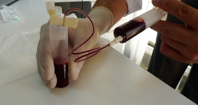 'Diz kireçlenmesinin tedavisi kendi kanımızda gizli'