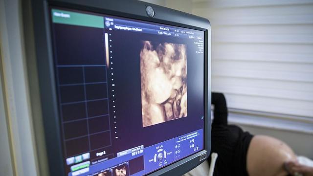 Doğumda annenin hayatını kurtaran yöntemde Türk imzası