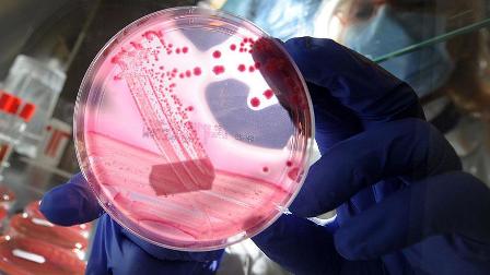 Dört gen pankreas kanserinde hayatta kalma şansını etkiliyor