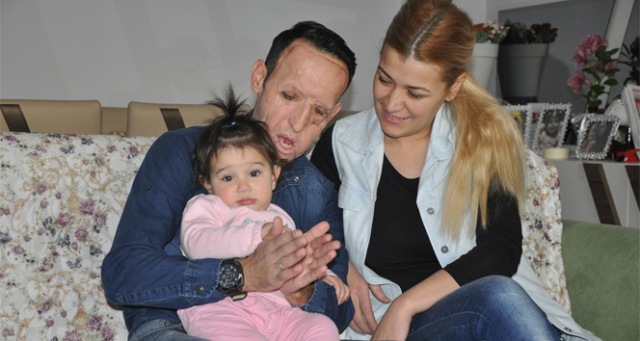 Yüz nakli olan Sert cezaevinde