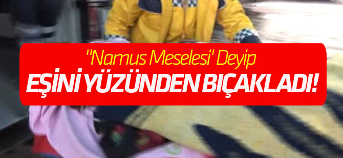"Namus Meselesi' Deyip Eşini Yüzünden Bıçakladı!
