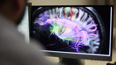 Beynin elektrik bağlantılarının haritası çıkarıldı