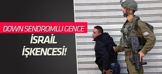 Down sendromlu Tavil: Önce dövdüler sonra bıraktılar