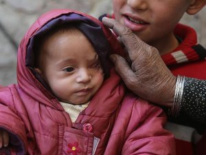 Doğu Gutalı Kerim bebek için destek büyüyor