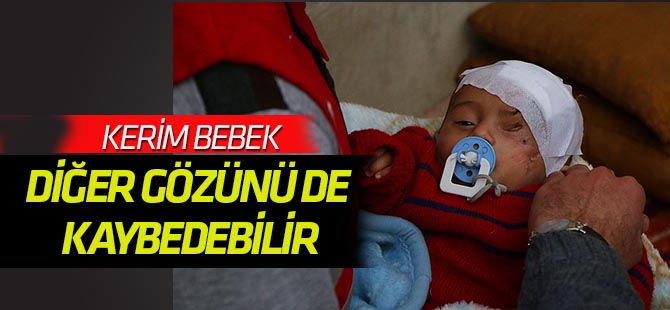 Doğu Gutalı Kerim bebek diğer gözünü de kaybedebilir