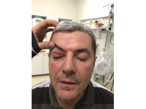 Konyaspor-Trabzonspor maçında protokol tribününde yumruklu kavga