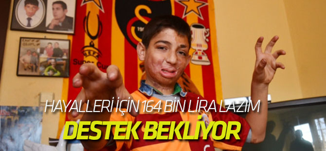 Küçük Hakkı'nın Hayalleri İçin 164 Bin Lira Lazım