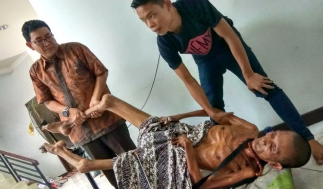 Geçirdiği kaza sonrası vücudu taşlaştı!