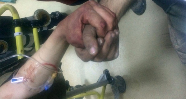 Yaralarını Unutup El Ele Tutuşan İki Mehmetçik'ten Tek Söz: Vatan Sağolsun