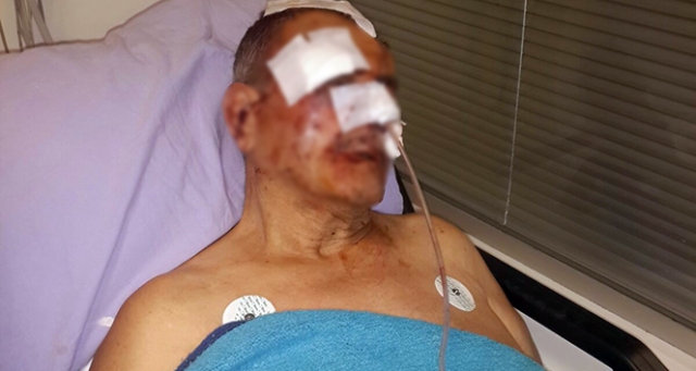 Komşusundan aidat istedi hastanelik oldu