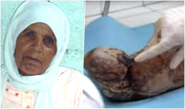 Doğumdan korktu, bebeğini 50 yıl doğurmadı!