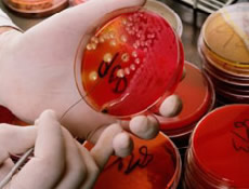 Bu virüs kansere ilaç olur mu?