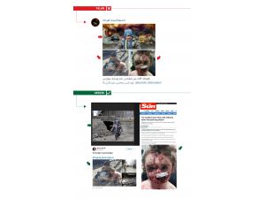 Köpek saldırısına uğrayan İngiliz çocuğu Afrinli gibi gösterdiler