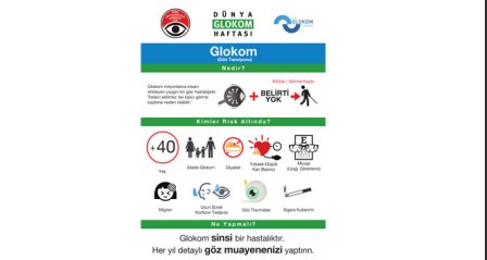 'Glokom, sinsice ilerliyor, körlüğe neden oluyor'