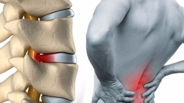 Bel Sağlığını Korumada 10 Temel Kural