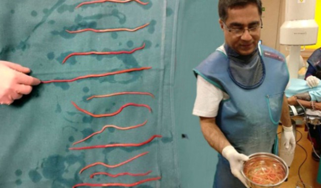 Vücudundan bir kase solucan çıktı!