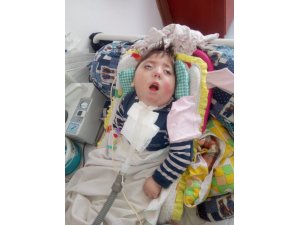 2,5 yaşındaki Ali İskender yardım bekliyor