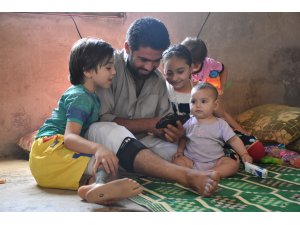 "Oğlum uyuyunca kesik bacağına bakıp ağlıyorum"