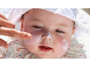 Çocuklarda güneş yanığına dikkat