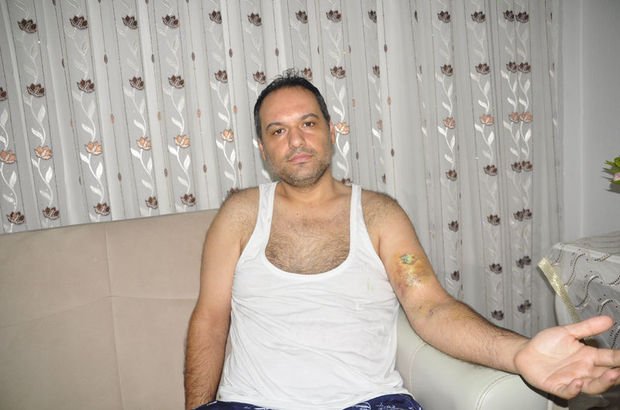 Tartıştığı hasta bakıcı kolunu ısırdı; 4 santimlik yırtık oluştu