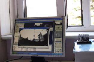 'Teletıp' projesi hayata geçiyor