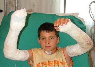 Yanan lastiğin üzerine düştü
