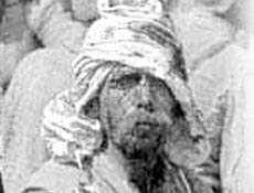 303 Türk askerini kör etmişler