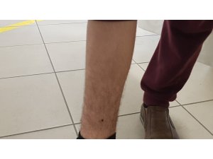 Kurban kesilirken ayağına ’kene’ yapıştı