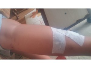 İnegöl’de başı boş köpekler dehşet saçmaya devam ediyor