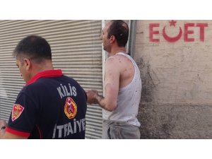 Kilis’te ev yangını: 1 yaralı